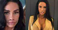 Katie Price geçirdiği operasyon sonrası son halini paylaştı
