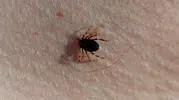 Doğu Karadeniz'de kene vakaları düşüşte
