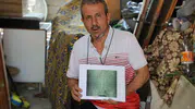 Adana'da ameliyat sonrası büyük ihmal Belinde metal unutuldu