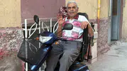 Oğlu tarafından yakılan yaşlı adama yeni umut