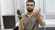 Elektrik kazasında uzuvlarını kaybeden Muhammed’e hayırseverlerden büyük destek