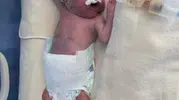 500 gramlık mucize Doruk bebek 5 ay sonra evine döndü