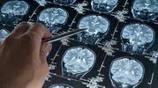 Hafıza kaybına karşı uykuda gizli savunma: Beyin dalgaları Alzheimer'ı durdurabilir