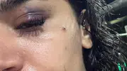 Uzaklaştırma kararı kalkan olmadı: Hemşire Ebru'nun çaresiz haykırışı