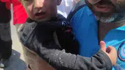 Bursa'da nefes kesen operasyon: 2,5 yaşındaki Emir'den gelen haber herkesi sevince boğdu