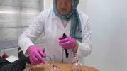 Hacamat yaptırırken sağlığınızdan olmayın: Uzmanından kritik uyarı