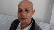 Alışverişe çıkan engelli vatandaşa sokak ortasında şiddet: Şüpheli kısa sürede serbest kaldı