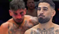 Gaethje maçından sonra ilk kez ortaya çıktı! Ilia Topuria'nın son hali görenleri şaşırttı
