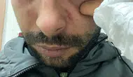 Hatay’da acil serviste doktordan hastaya yumruklu saldırı