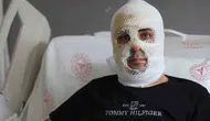Hataylı esnafın ekmek teknesi alevlere teslim oldu