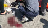Nusaybin'de motosikletten düşen kadın yaşam savaşı veriyor