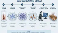 Kellik tarihe mi karışıyor? Saç klonlamasında büyük gelişme?