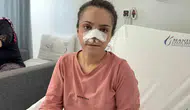 Manisa'da dehşet anları Eşi tarafından koparılan burun yerine dikildi