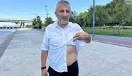 Kalbinde 10 yıllık bir mermiyle vatan nöbetini sürdürüyor