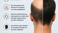 Kel olanlara müjde Saç klonlama dönemi başlıyor