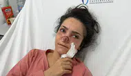 Manisa’da dehşet anları Eşi tarafından burnu koparıldı
