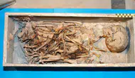 Medici hanedanındaki 500 yıllık cinayet şüphesini bitiren DNA analizi: Zehir değil sıtma çıkardı