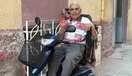 Oğlu tarafından yakılan yaşlı adama yeni umut