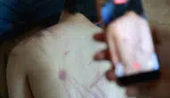 Rehabilitasyon merkezinde skandal darp iddiası