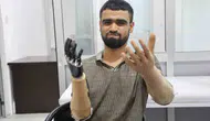 Elektrik kazasında uzuvlarını kaybeden Muhammed’e hayırseverlerden büyük destek