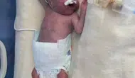 500 gramlık mucize Doruk bebek 5 ay sonra evine döndü