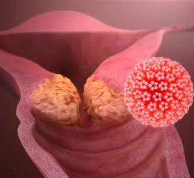 O ilimizde HPV aşısı ücretsiz!