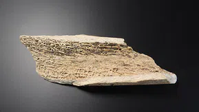 Bilim insanlarından müjde: Sağlıklı kemikler için yeni bir yol bulunmuş olabilir