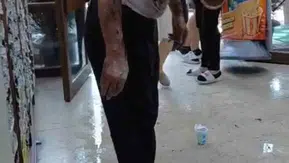 Bursa merkezdeki iş hanında lavabo açıcı patladı