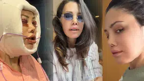 Didem Ceran yüz estetiği operasyonları nedeniyle doktorlarını dava ediyor