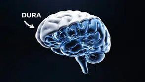 Neuralink ameliyatlarında devrim Beyin zarı artık kesilmeden çip takılıyor