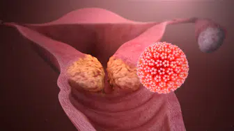 O ilimizde HPV aşısı ücretsiz!