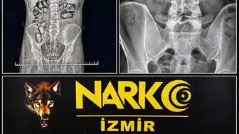 Havalimanında kuryelik girişimi: Mideye gizlenen zehir operasyonla ortaya çıktı