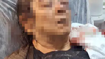Kayseri'de evde oturduğu sırada dehşeti yaşadı: Tavandan kopan parçalar görme yetisini elinden aldı