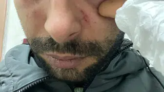 Hatay’da acil serviste doktordan hastaya yumruklu saldırı
