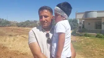 Şanlıurfa’da köpek dehşeti 8 yaşındaki çocuk son anda kurtarıldı