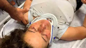 İzmir'de vahşi tuzak Hayvanseveri yardıma çağırıp boğmaya çalıştı