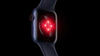 Apple Watch Series 12 sensörlü kordonla sağlık takibini değiştirebilir