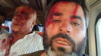 Arazi kavgası kanlı bitti: Taşlı sopalı çatışmada 8 yaralı