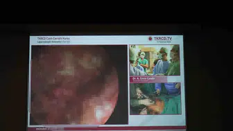 Erzurum’da doktorlar ameliyatı canlı yayında izledi