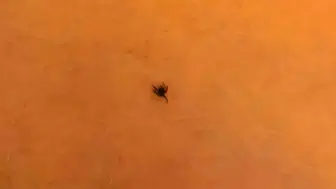 İnegöl'de oyun oynayan çocuğun göğsüne kene yapıştı