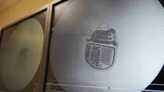 Kronik ağrı çekenlere 10 bin dolarlık devlet destekli çözüm