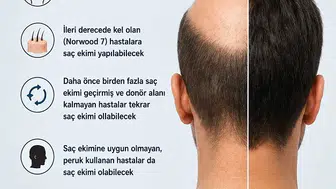 Kel olanlara müjde Saç klonlama dönemi başlıyor
