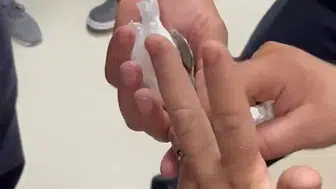 Kozan’da parmağına sıkışan yüzük itfaiye yardımıyla kesildi