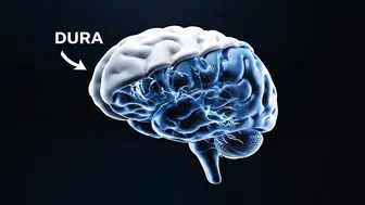 Neuralink ameliyatlarında devrim Beyin zarı artık kesilmeden çip takılıyor