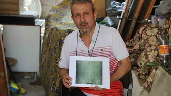 Adana'da ameliyat sonrası büyük ihmal Belinde metal unutuldu