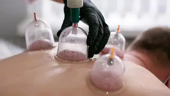 Hacamat yaptırırken sağlığınızdan olmayın