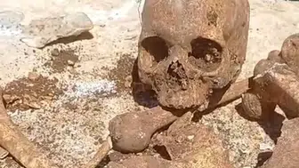 Malatya’daki inşaat temelinden insan kemikleri çıktı