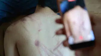 Rehabilitasyon merkezinde skandal darp iddiası