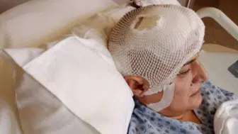 Diş hekimi koltuğunda başlayan kabus: İmplant sonrası hayatı tamamen değişti