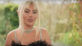 Fenomen Pınar Özkurteller bu kez göz rengini değiştirdi